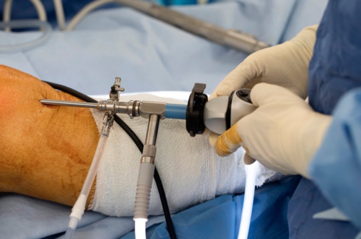 Arthroscopy-----12