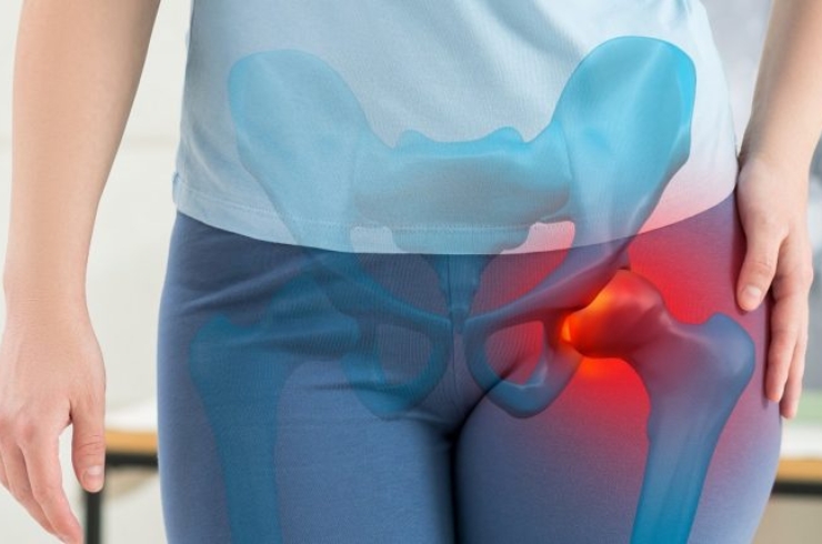 Hip Replacement------12